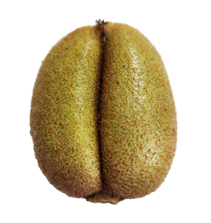 畸形